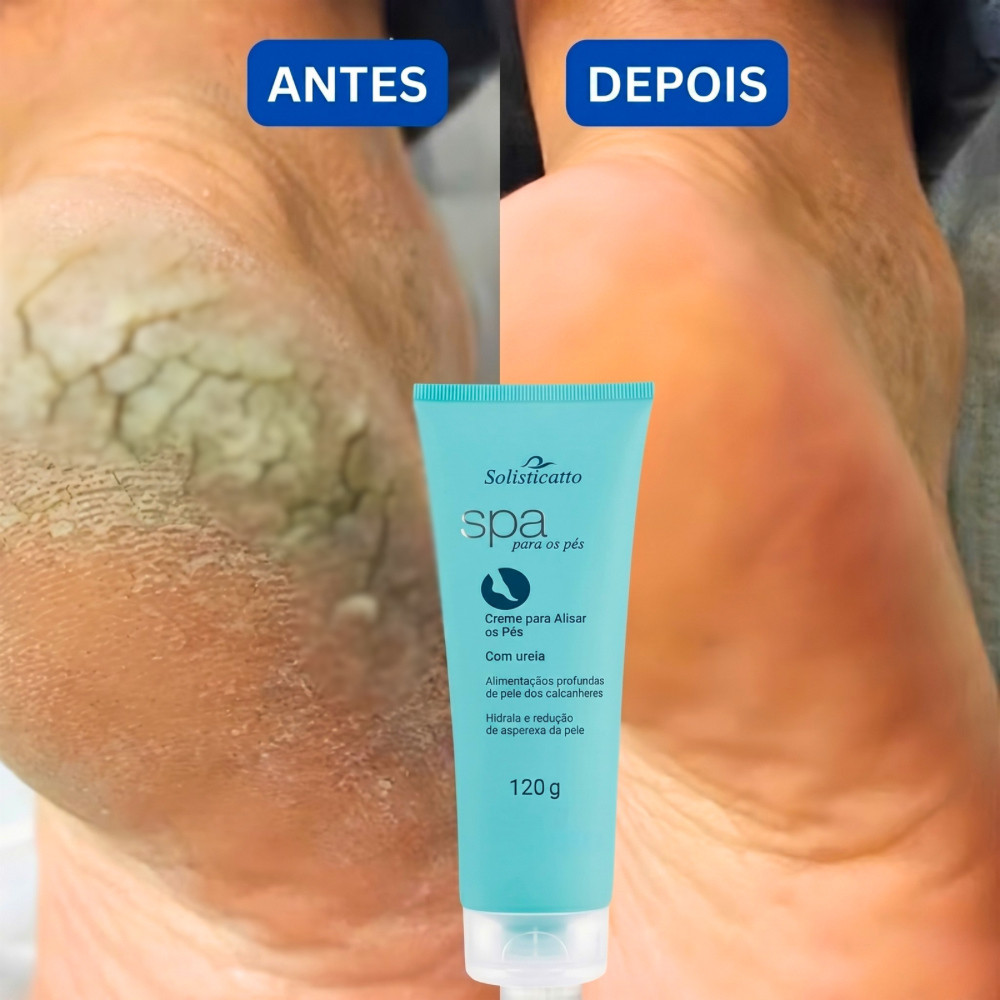 Creme para Pés Rachados Ressecados e Fissurados Spa dos Pés Ureia 10% Hidratação Profunda Calcanhar